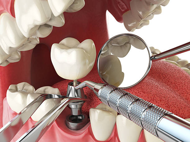 Best Urgent Tooth Repair  in Jackson, MN